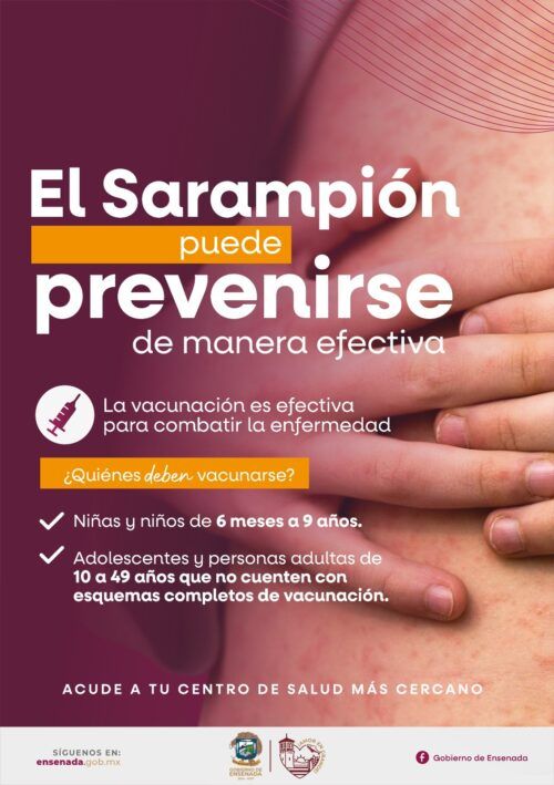 LLAMAN A REFORZAR MEDIDAS PREVENTIVAS CONTRA EL SARAMPIÓN