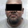 CONDUCTOR EN ESTADO DE EBRIEDAD ES DETENIDO POR LA POLICÍA DE TECATE TRAS PROVOCAR ACCIDENTE DE TRÁNSITO