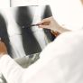 LLAMAN A PREVENIR LA OSTEOPOROSIS MEDIANTE HÁBITOS SALUDABLES Y DETECCIÓN OPORTUNA